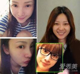 整容脸素颜生活照,整容脸的真实生活瞬间